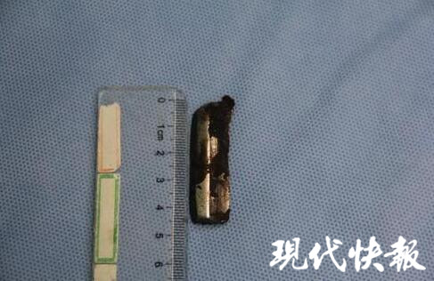 IM电竞 电子竞技平台机器零件飞出工人意外“中弹”(图1)