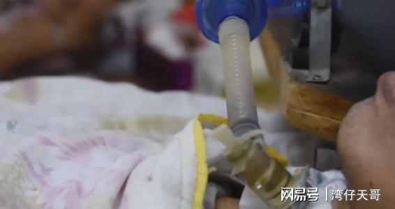 哥哥自制无价呼吸机为弟续命用简陋的零件换来12IM电竞 IM电竞平台年每一口呼吸(图38)