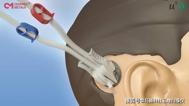 微观尺度的精密工程IM电竞 IM电竞平台